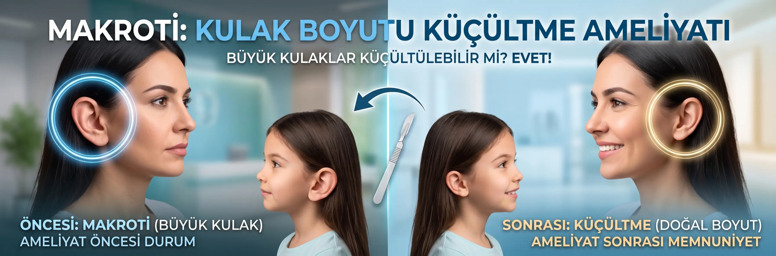 Kulak Boyutu Küçültme Ameliyatı